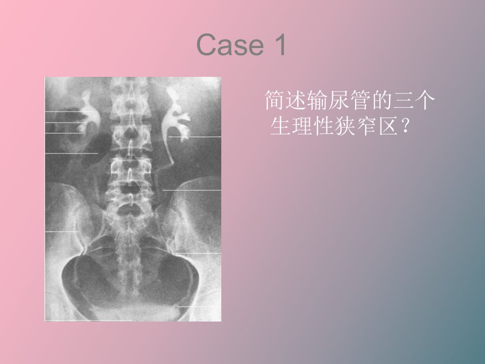 泌尿系常见病、多发病