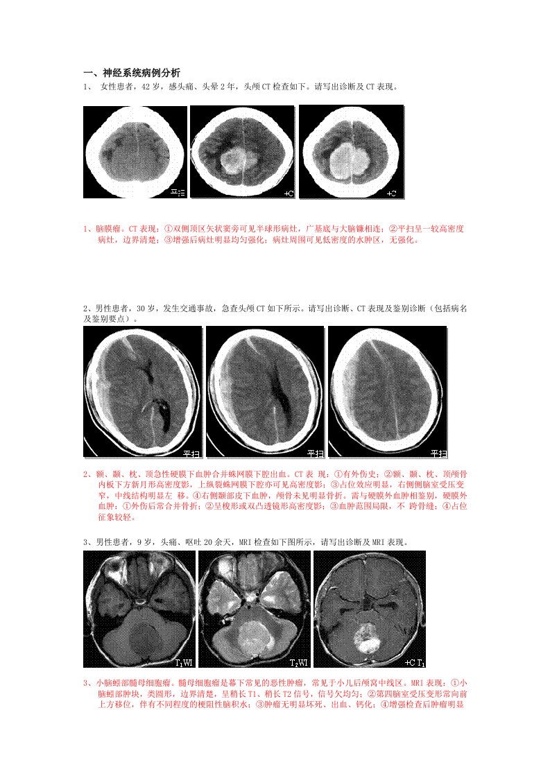 典型影像学片