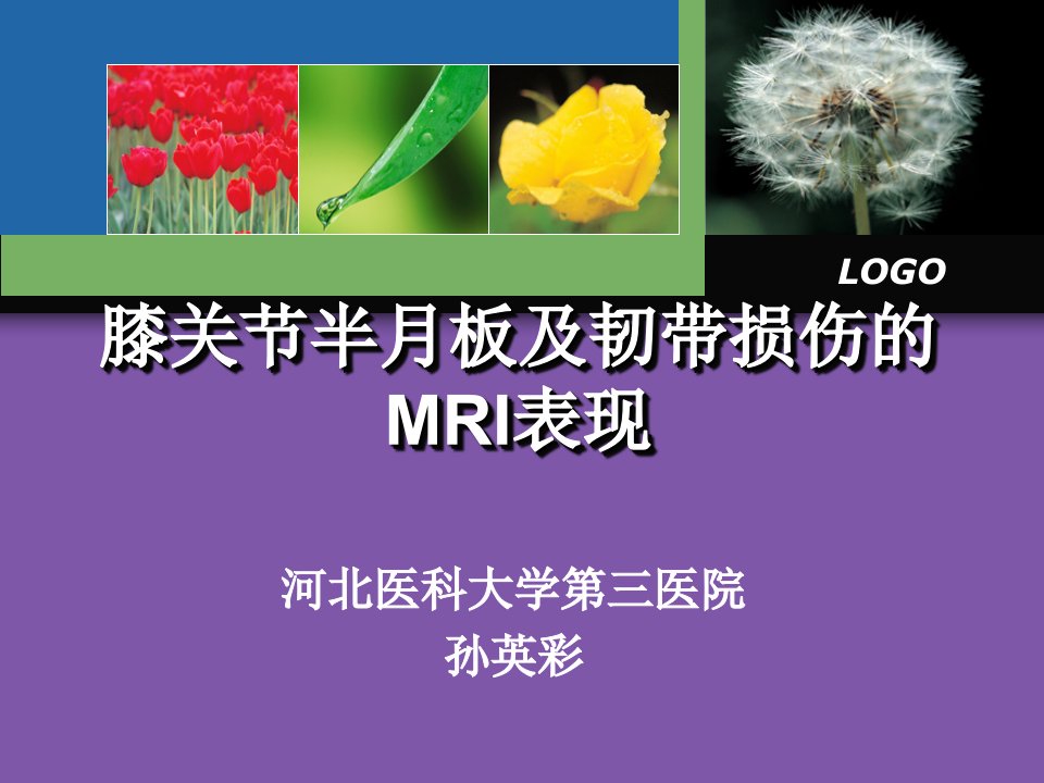 膝关节半月板及韧带损伤的MRI表现