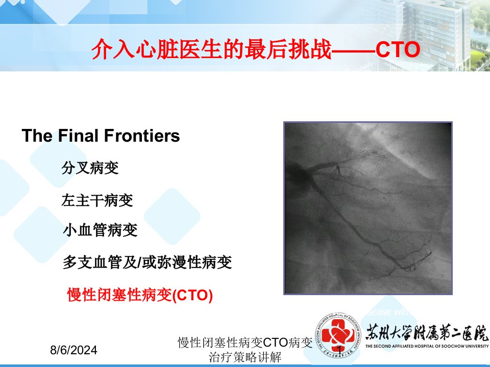 2021年慢性闭塞性病变CTO病变治疗策略讲解