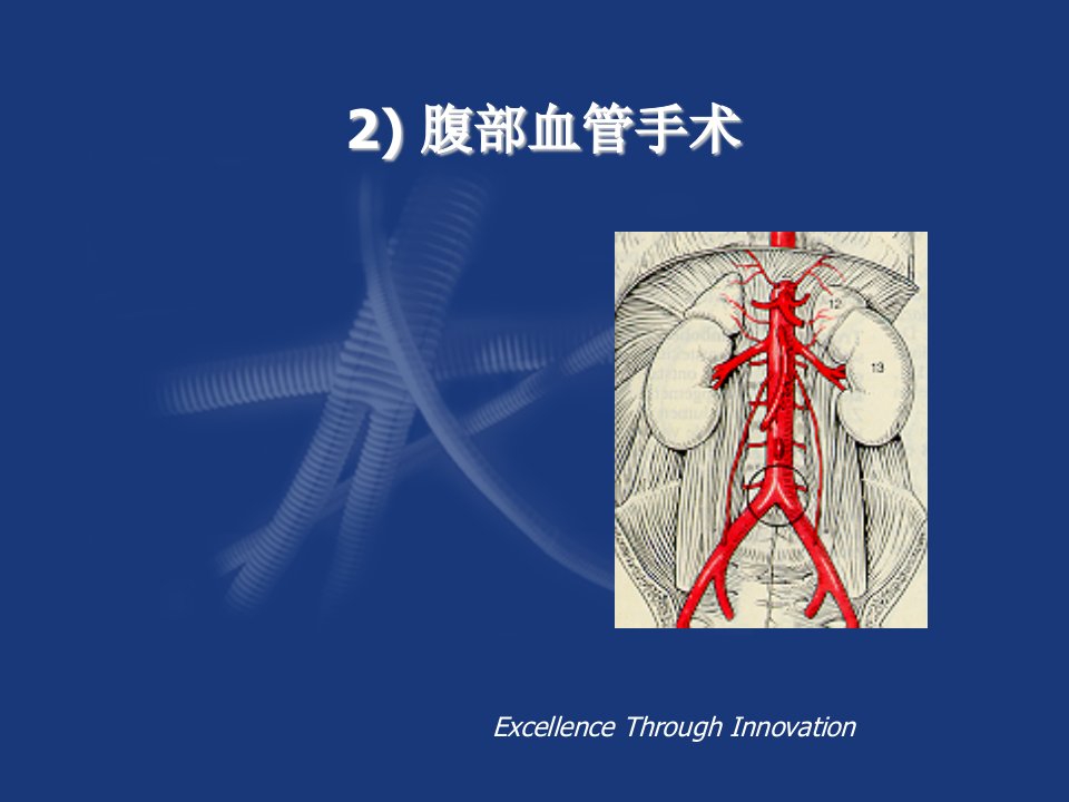 阜外大血管腹部血管手术