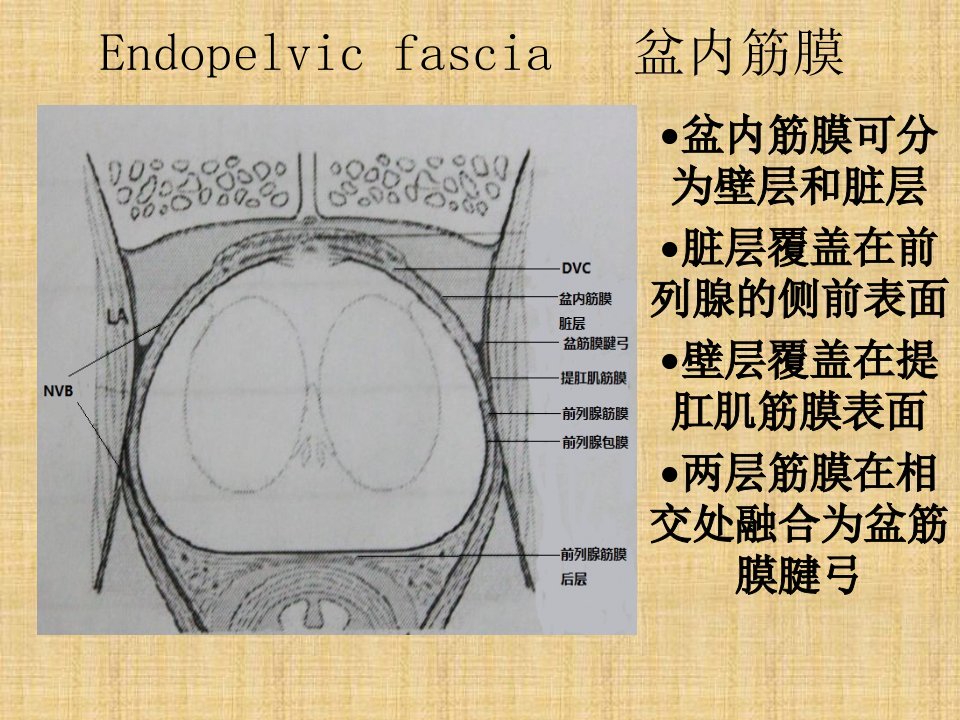 筋膜内根治性前列腺切除术