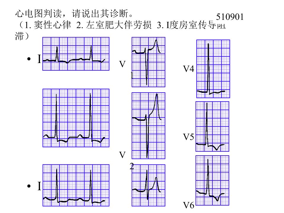 心电图试题及答案