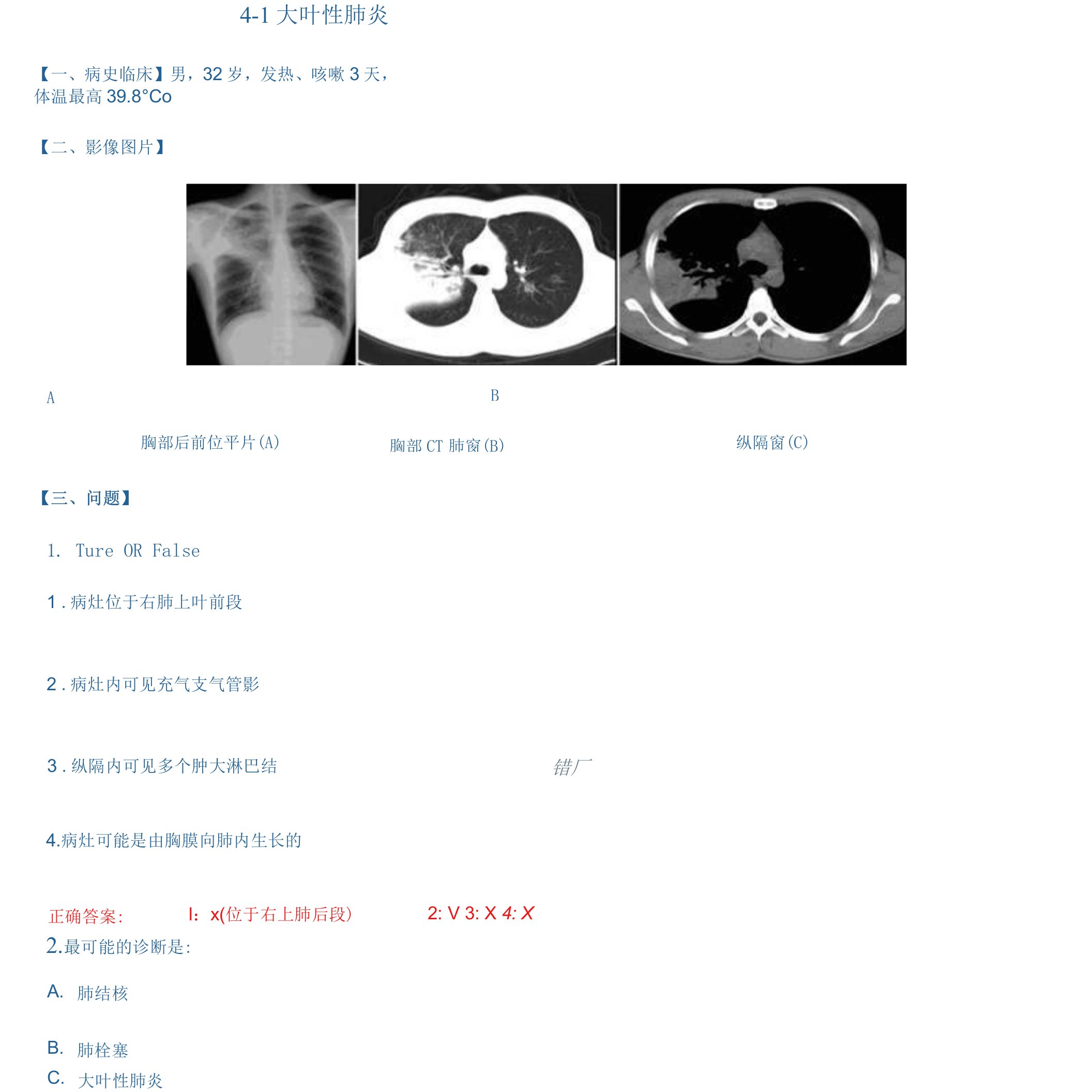 医学影像典型病例讨论：4