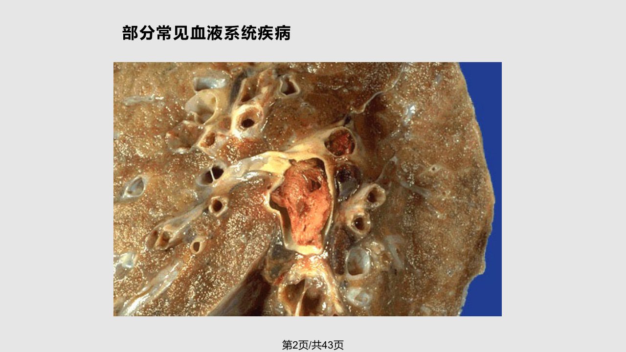 作用于血液和造血系统药物