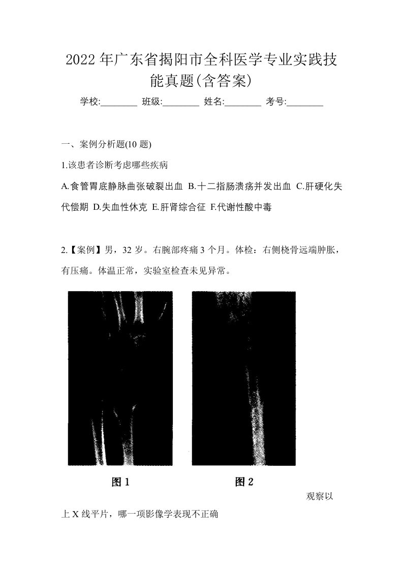 2022年广东省揭阳市全科医学专业实践技能真题含答案