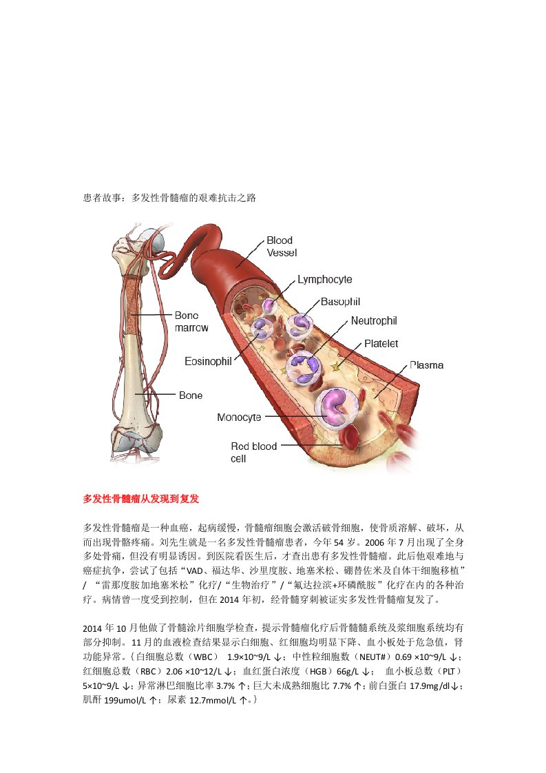 患者故事：多发性骨髓瘤的艰难抗击之路