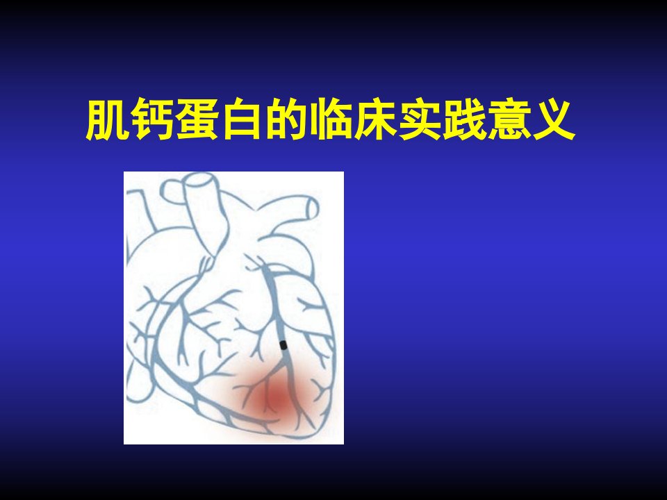 肌钙蛋白的临床实践意义