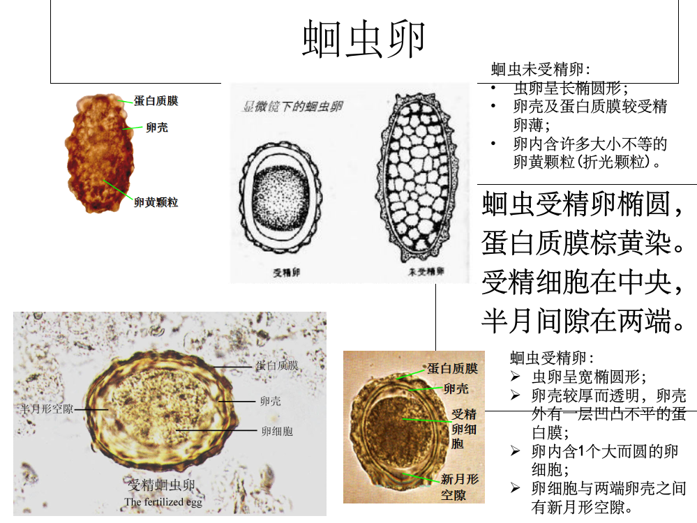 寄生虫学虫卵经典总结及图片