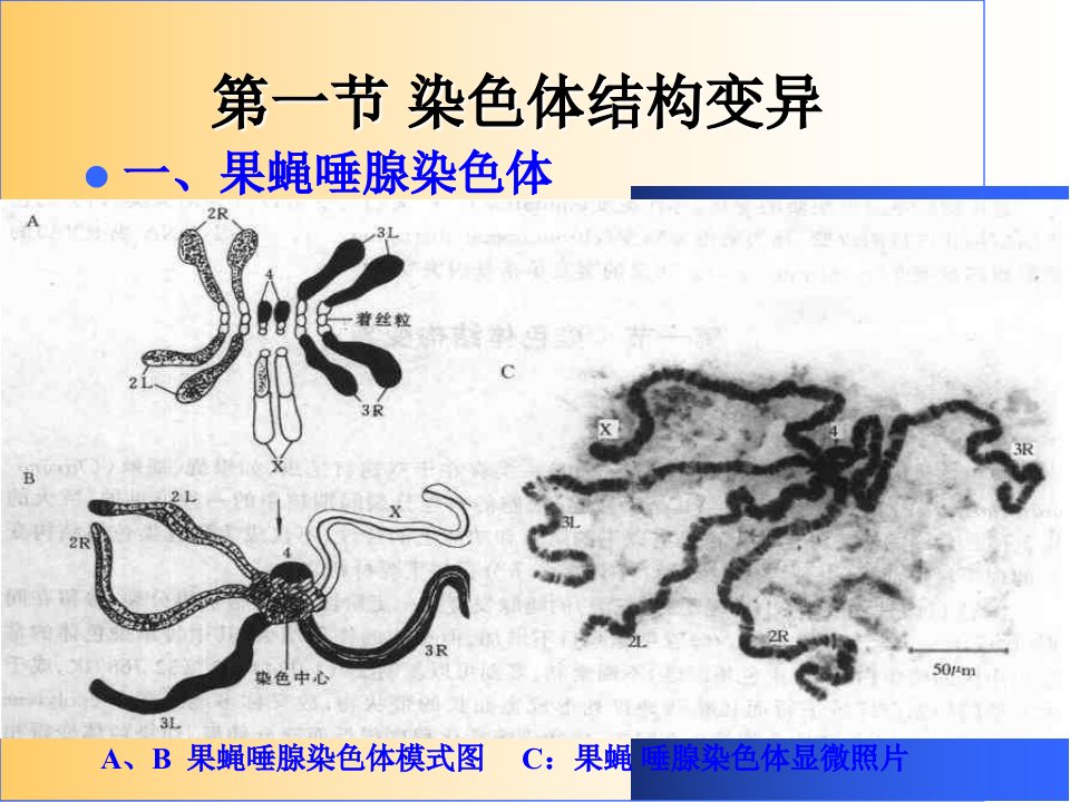 染色体畸变