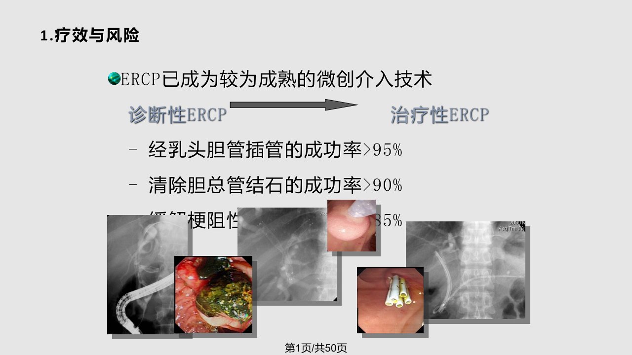 ercp治疗胆胰疾病PPT课件