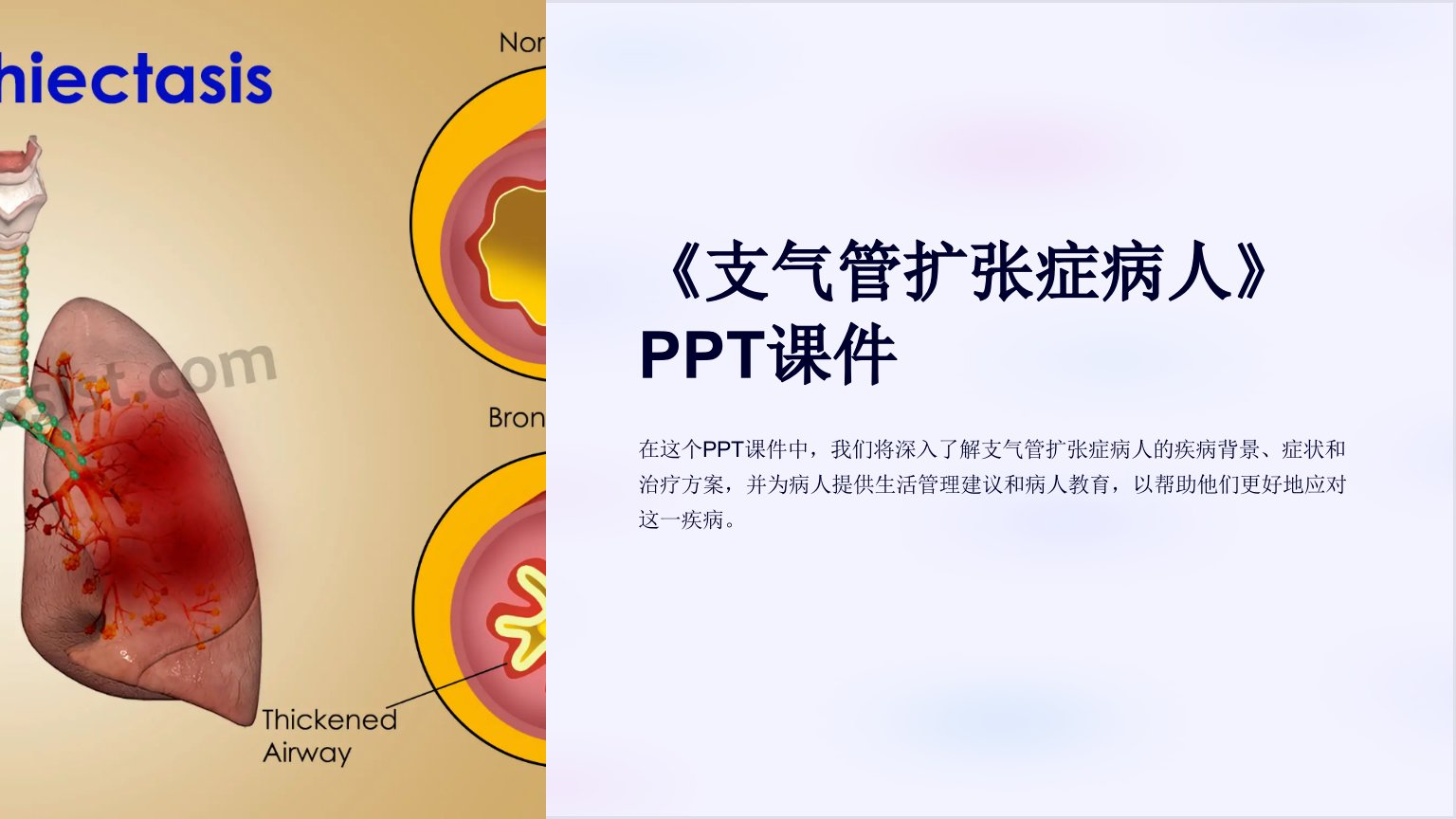 《支气管扩张症病人》课件