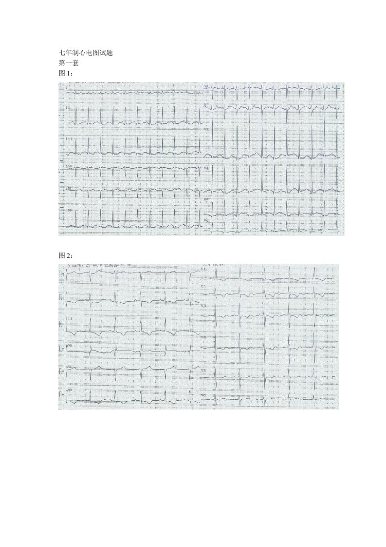 心电图试题及标准答案