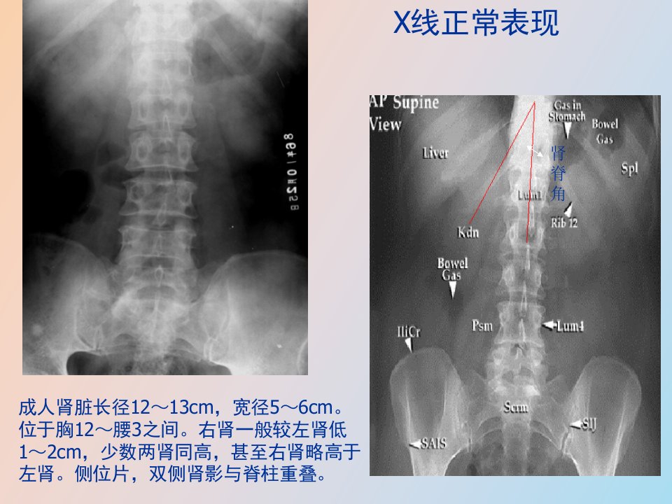 泌尿系统影像