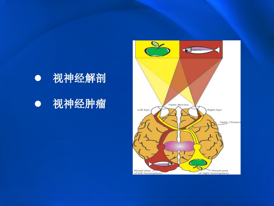 视神经肿瘤影像学表现及鉴别讲义