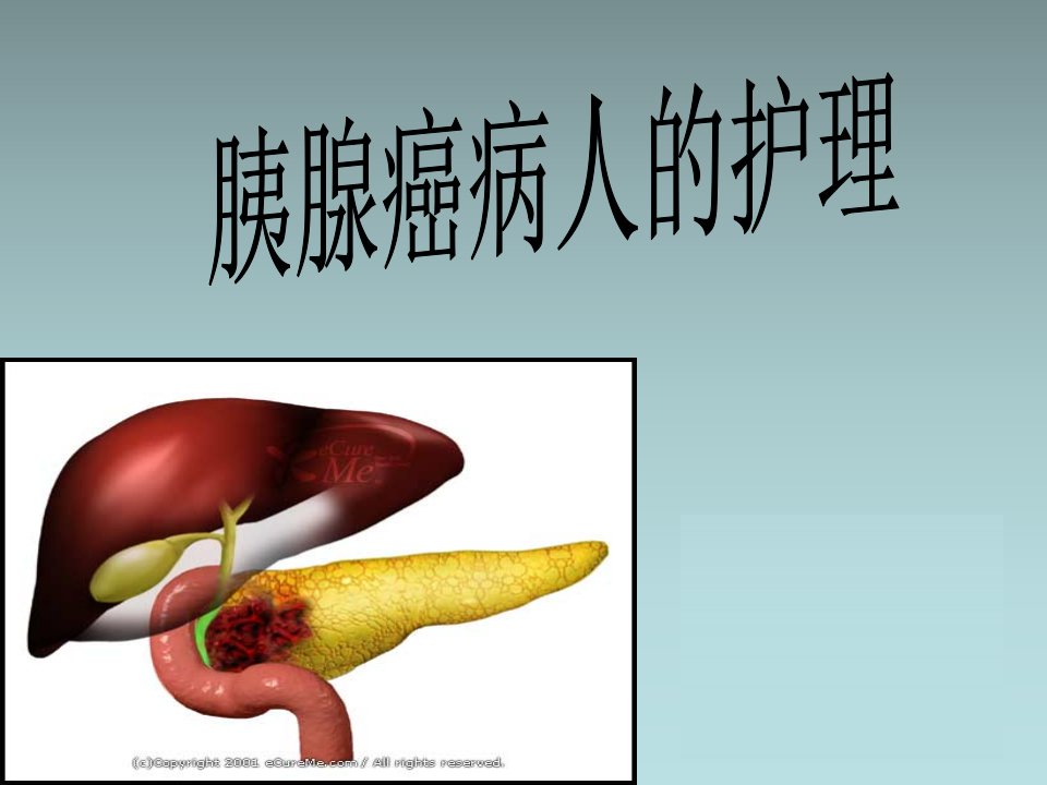 胰腺癌病人的护理