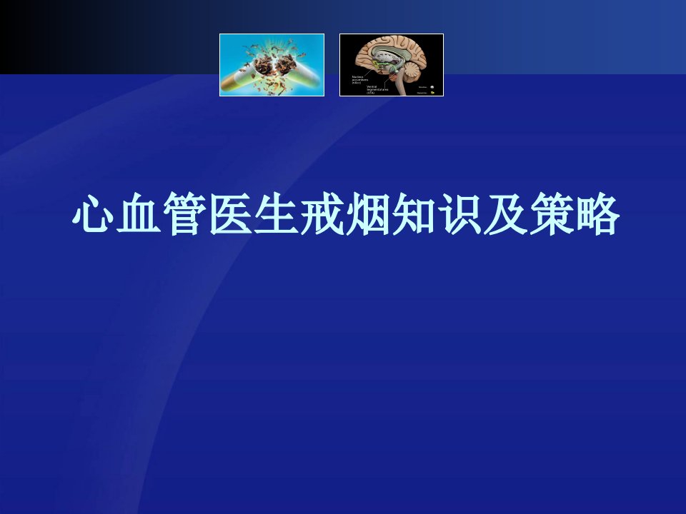 心血管医生戒烟知识及策略