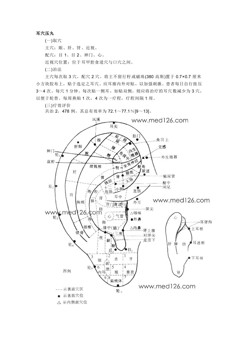 耳穴压丸