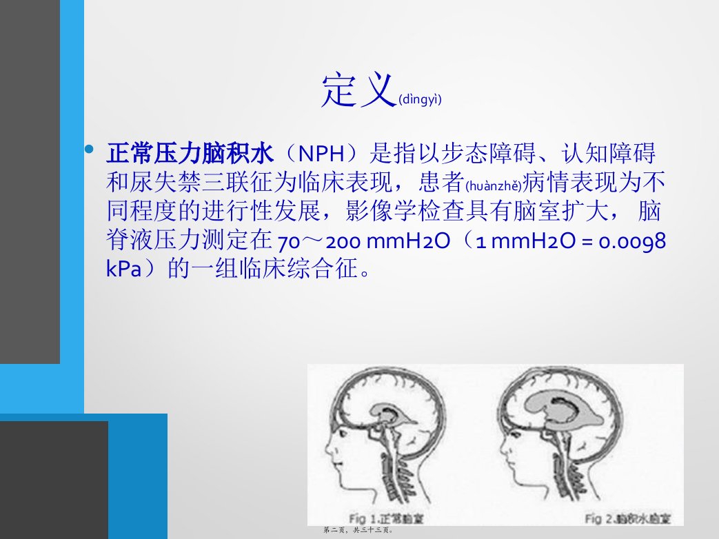 医学专题中国特发性正常压力脑积水诊治专家共识