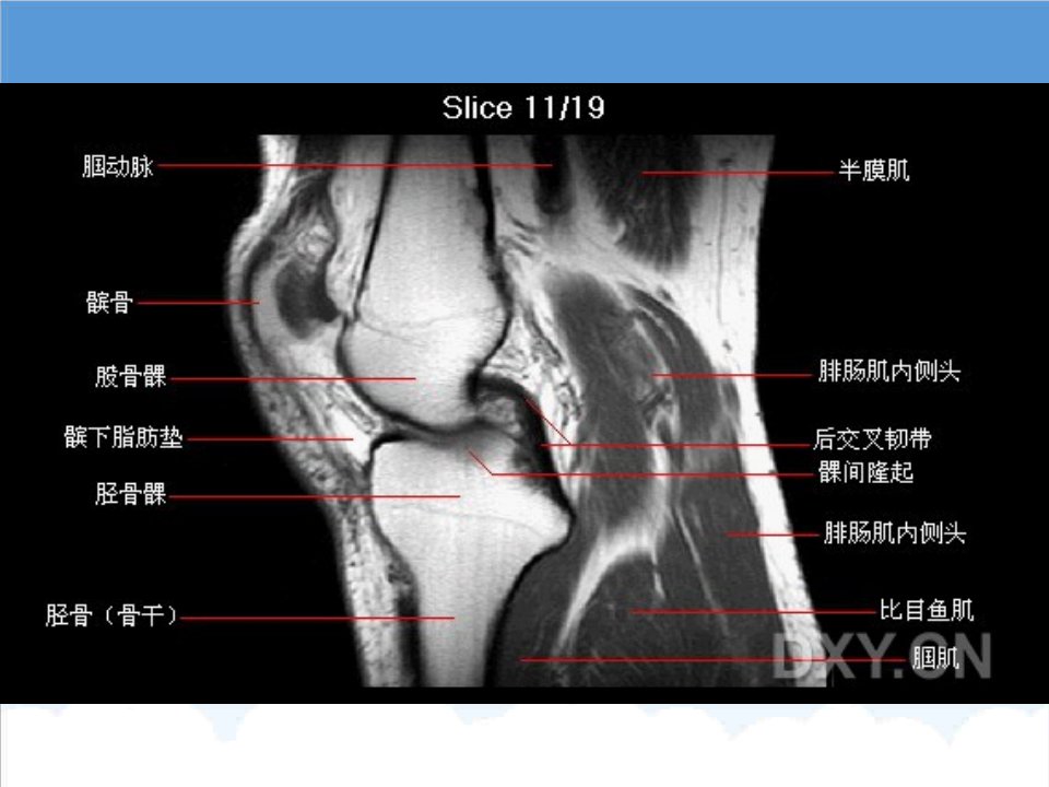 基础医学人体解剖学3膝部MRI解剖