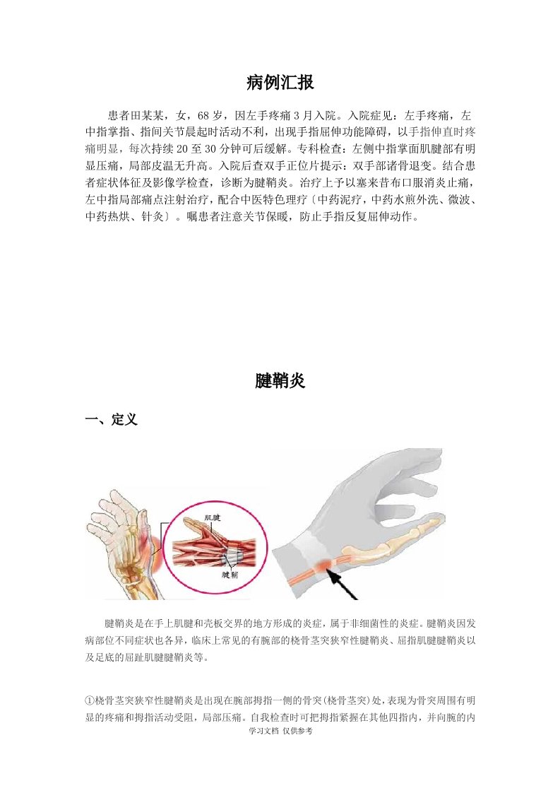 腱鞘炎（知识讲座）