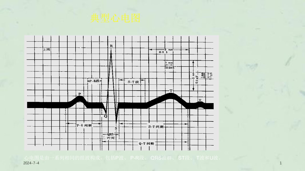 心电图入门精要最新课件