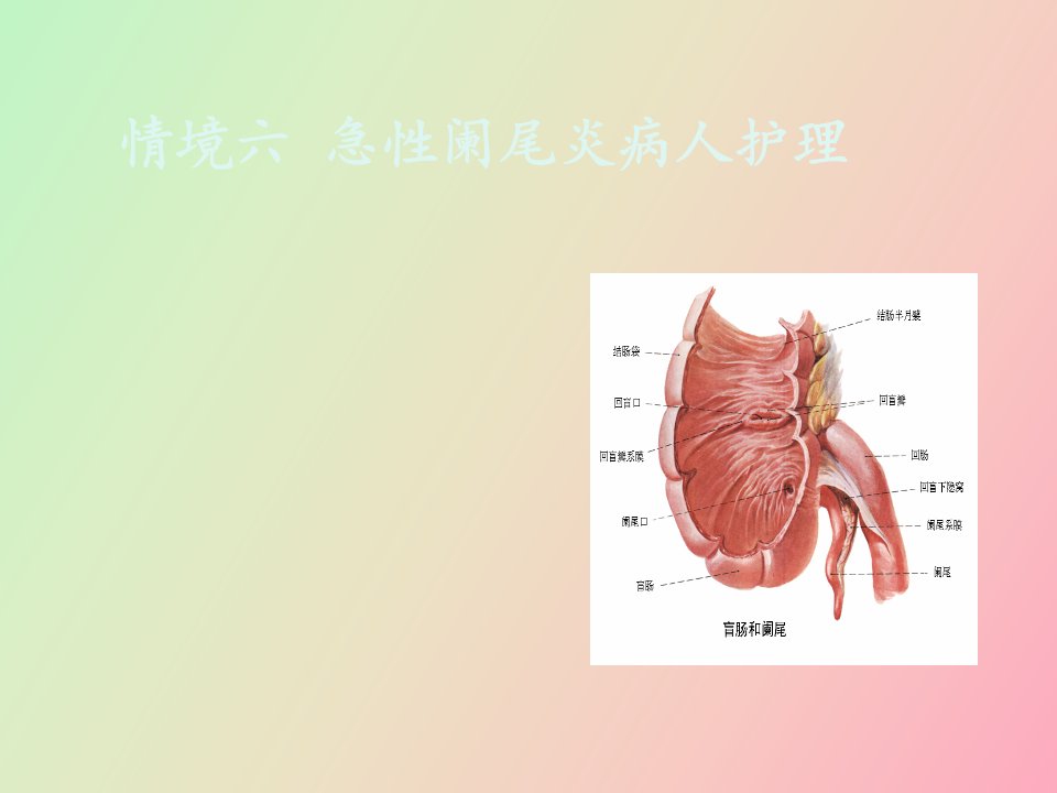 急性阑尾炎实训