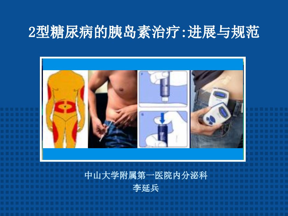 2型糖尿病的胰岛素治疗进展与规范.ppt