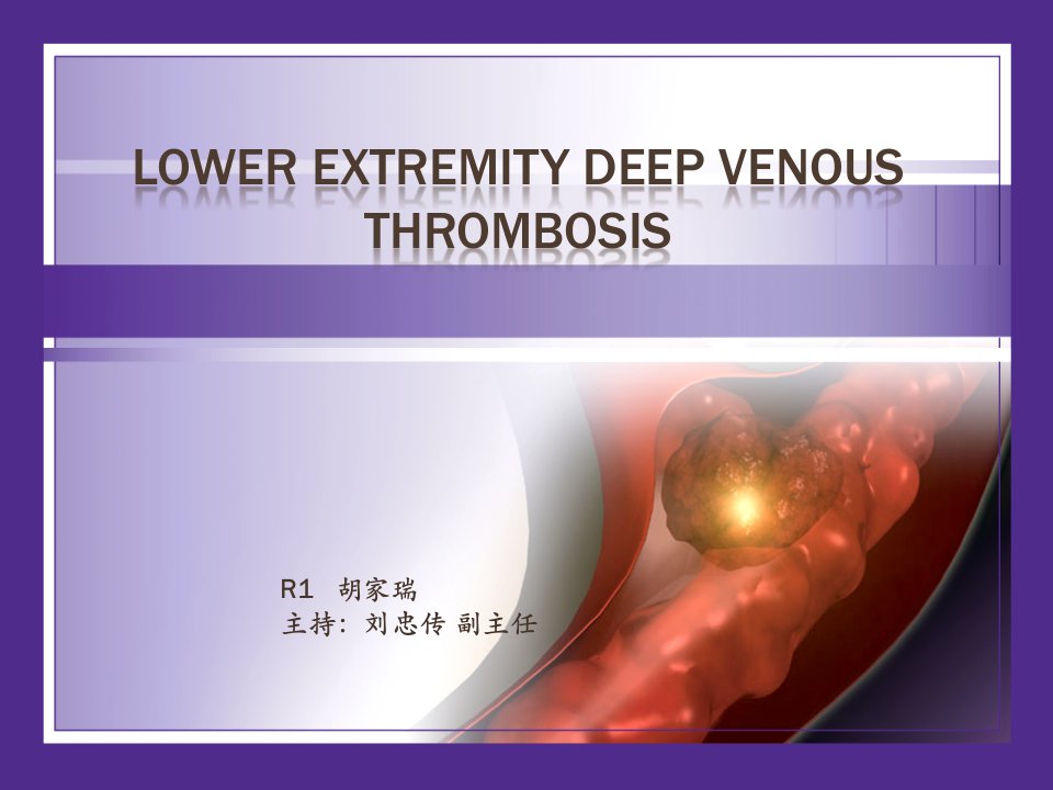 深静脉血栓DVT