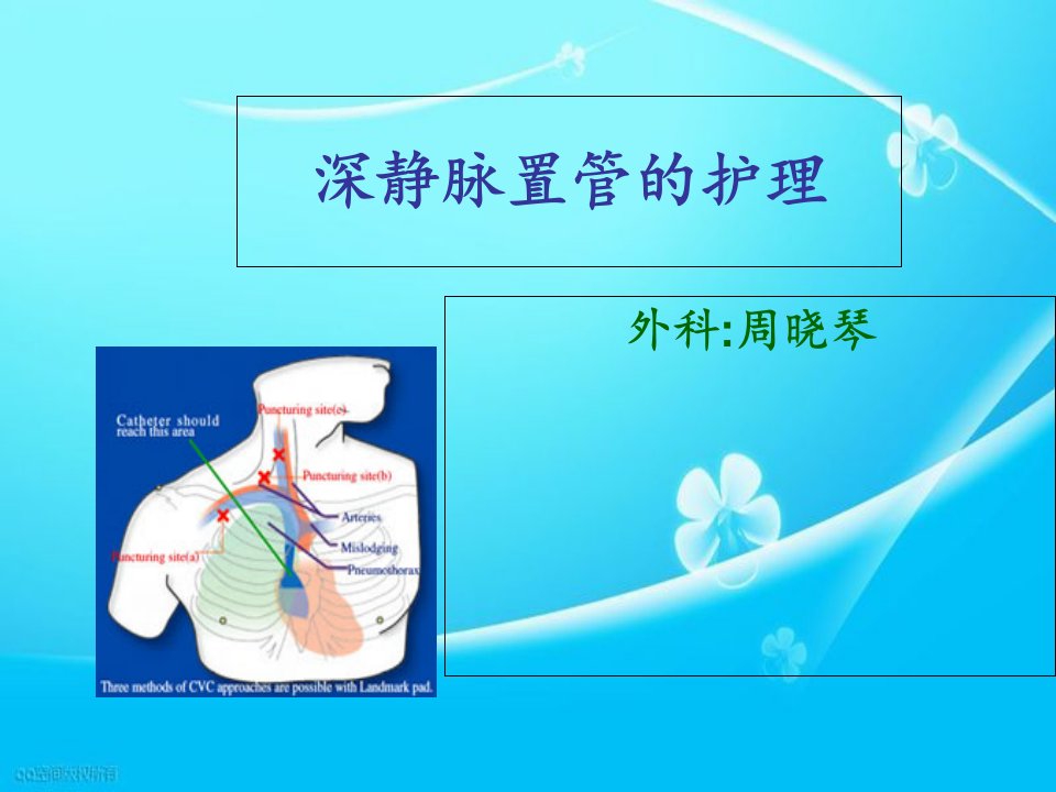 深静脉置管的护理