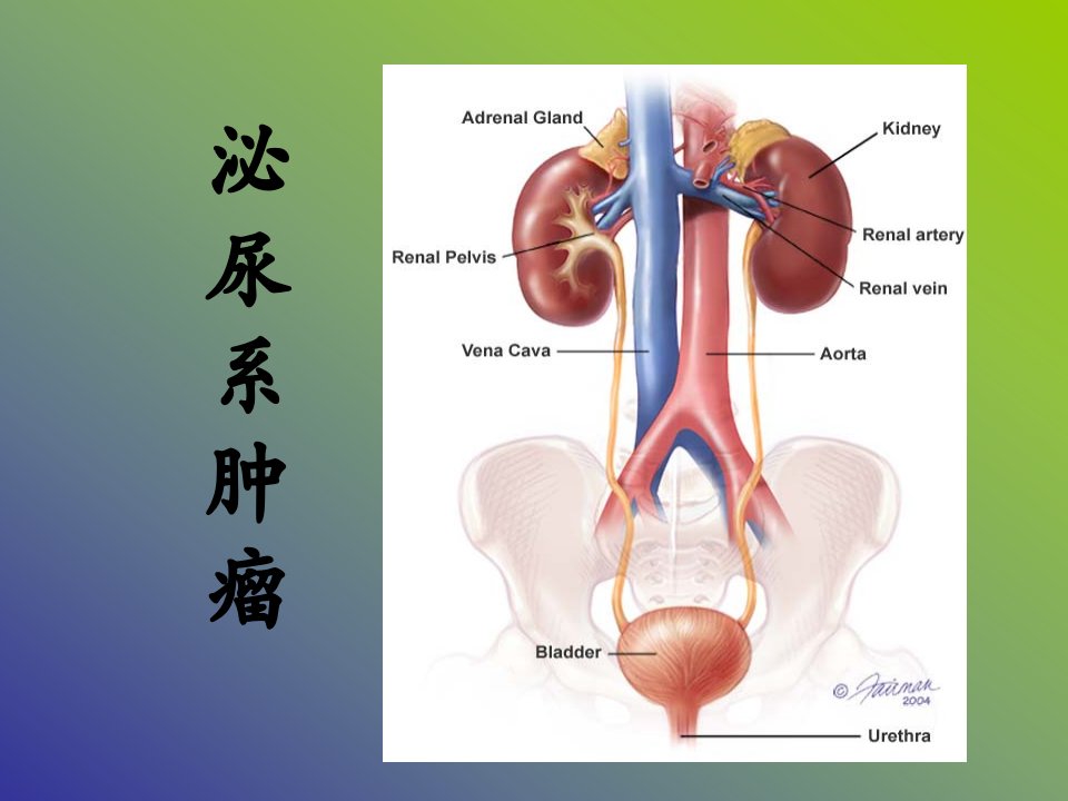 膀胱肿瘤