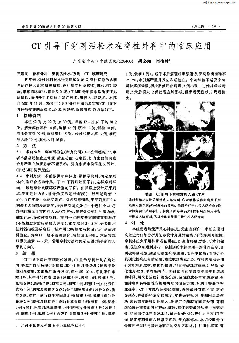 CT引导下穿刺活检术在脊柱外科中的临床应用.pdf