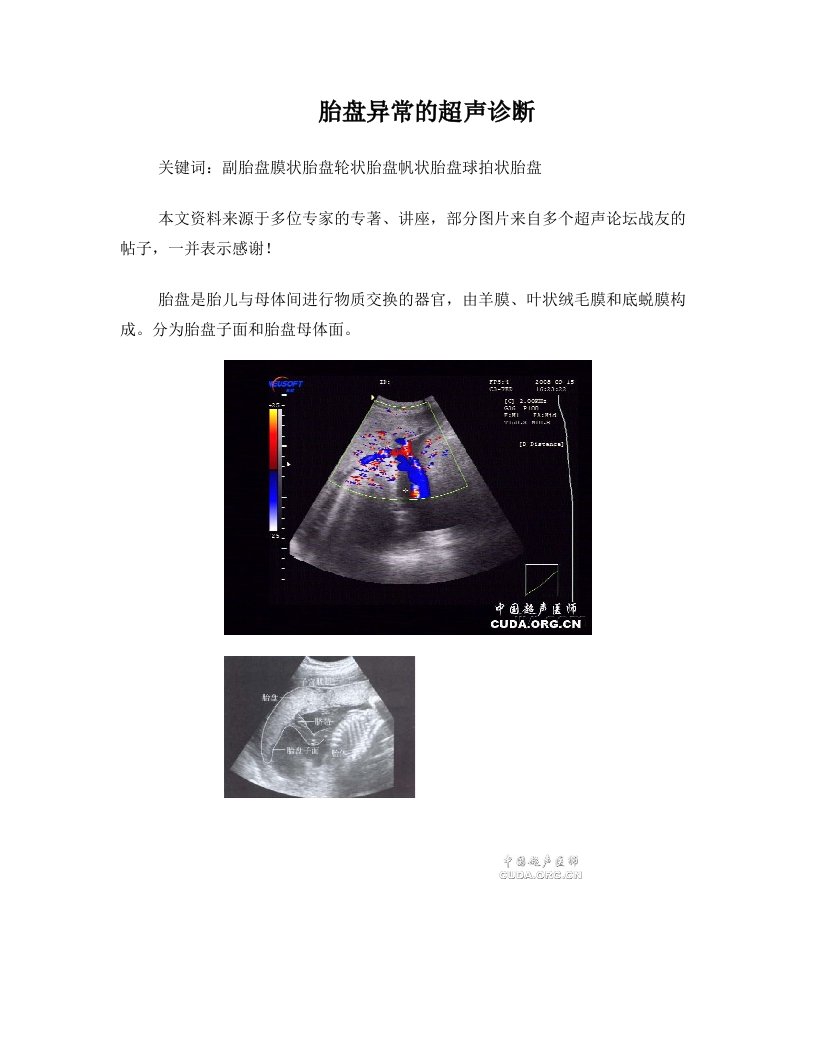 胎盘异常的超声诊断