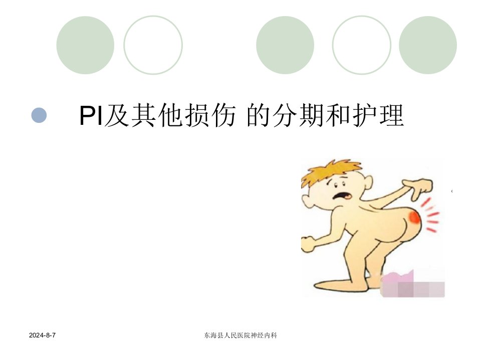 《压疮的分类及护理》PPT课件