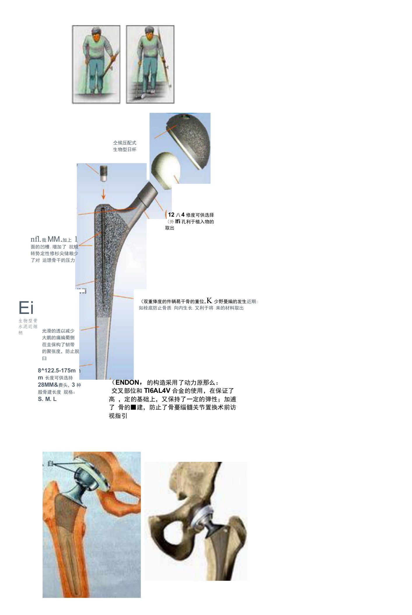 手术室髋关节置换术前访视指引