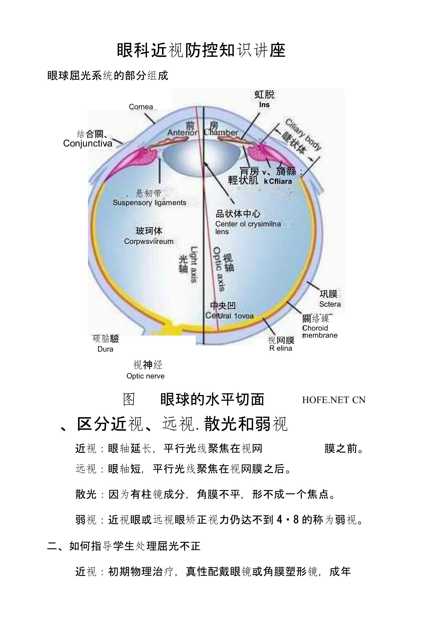 眼科近视防控知识讲座