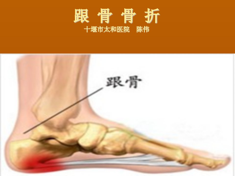 跟骨骨折护理