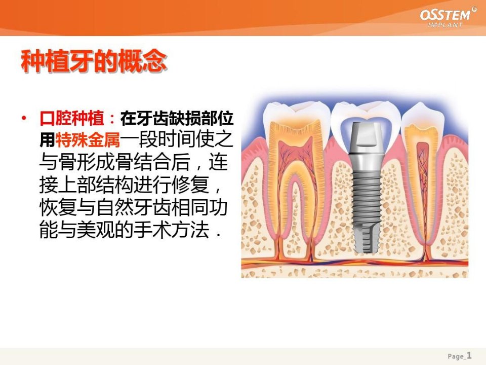 种植牙Osstem-基础