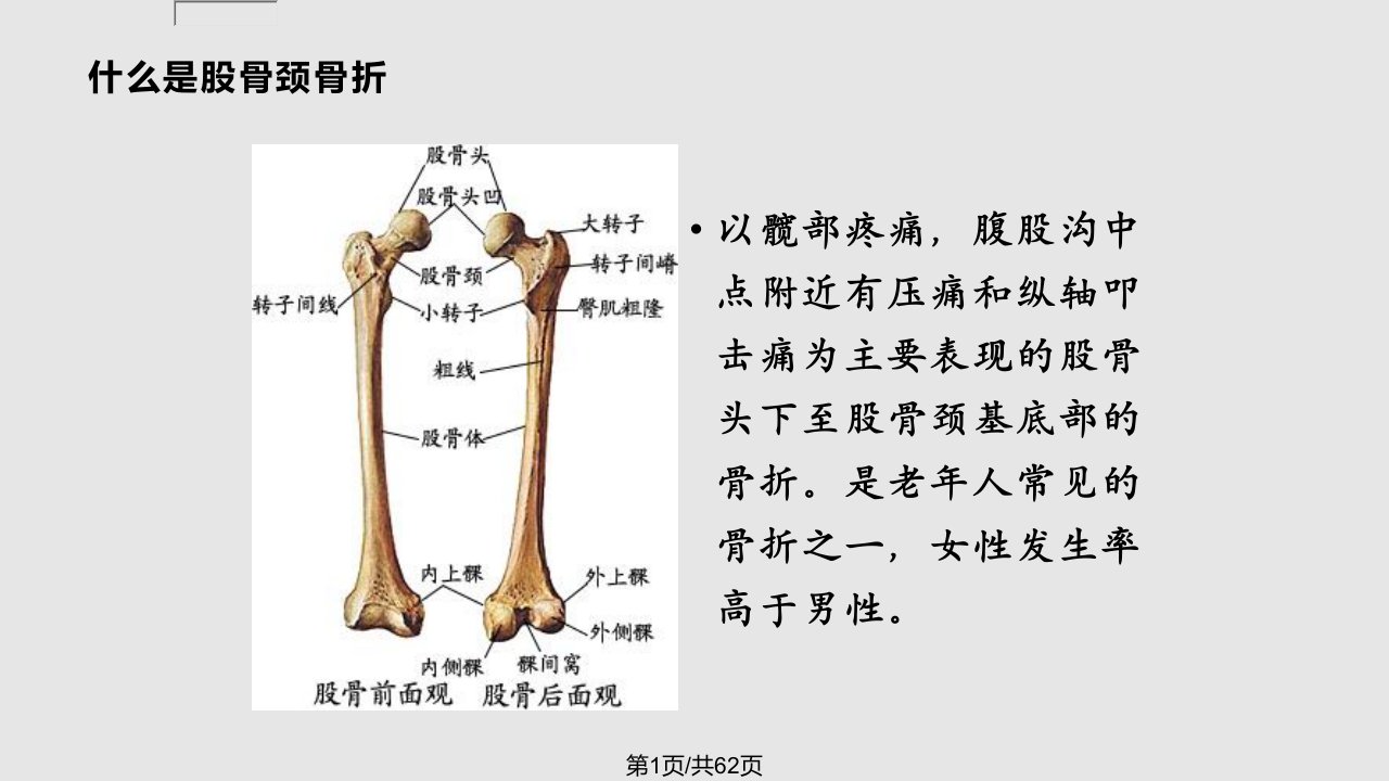 股骨颈骨折合并糖尿病的护理PPT课件