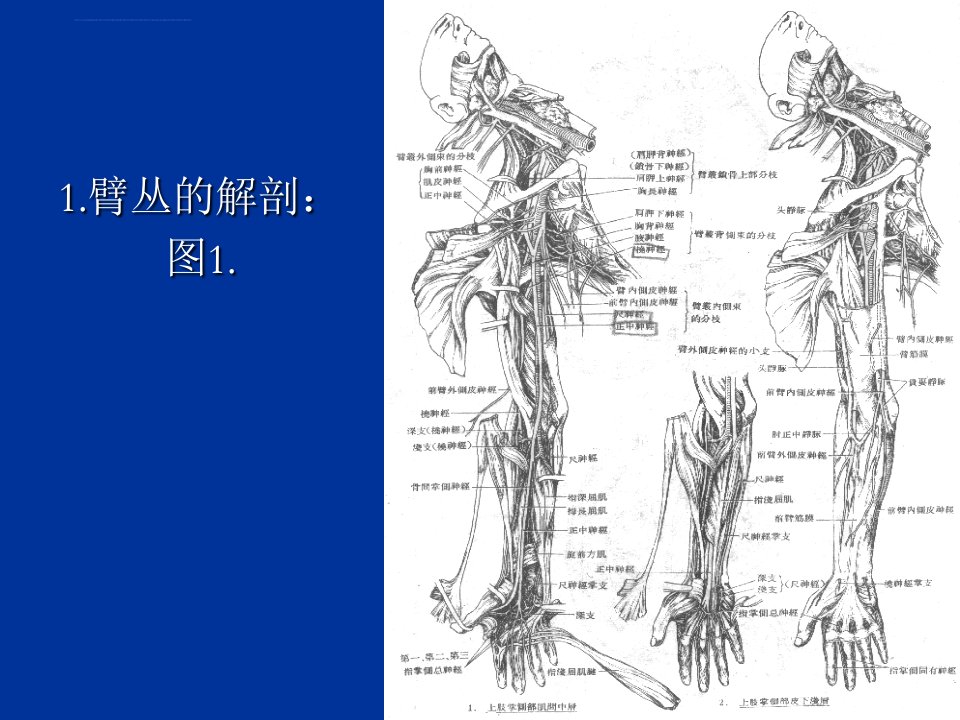 臂丛神经损伤