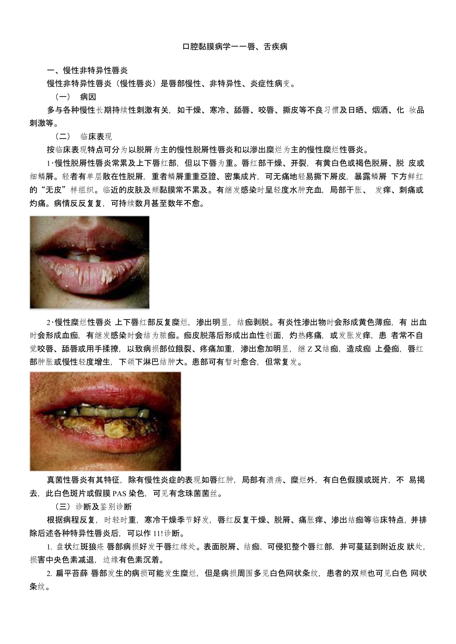 主管护师护士护理考研资格考试题库口腔黏膜病学唇、舌疾病