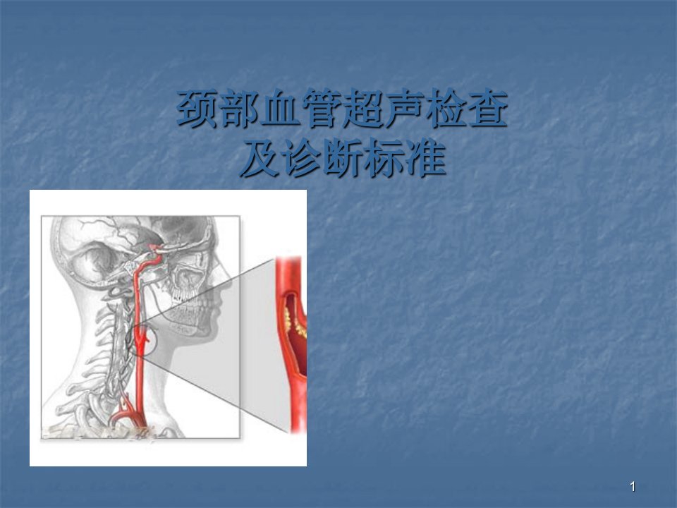 颈部血管超声检查及诊断标准ppt课件