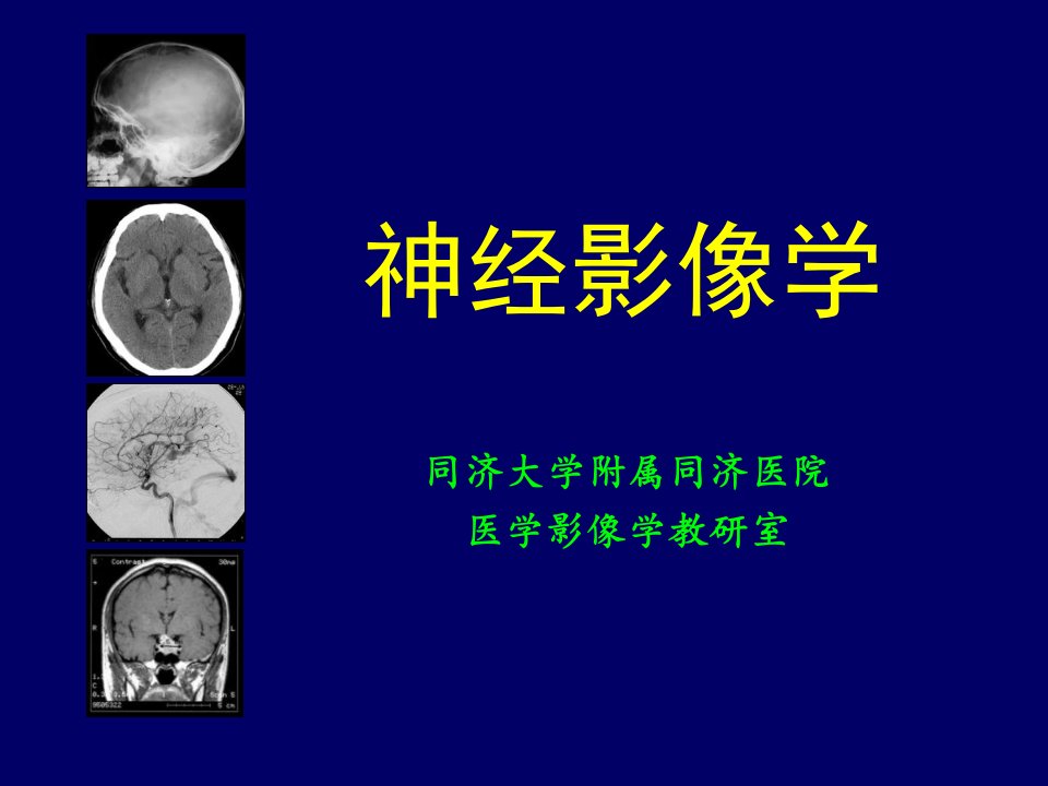 《神经影像学》PPT课件