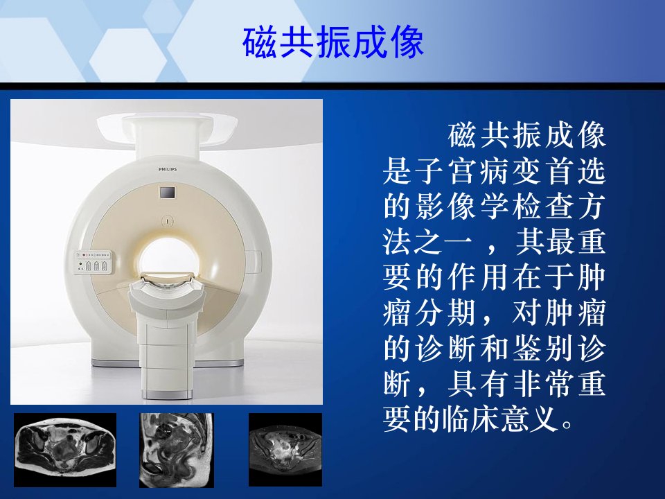 医学专题子宫内膜癌的MRI表现