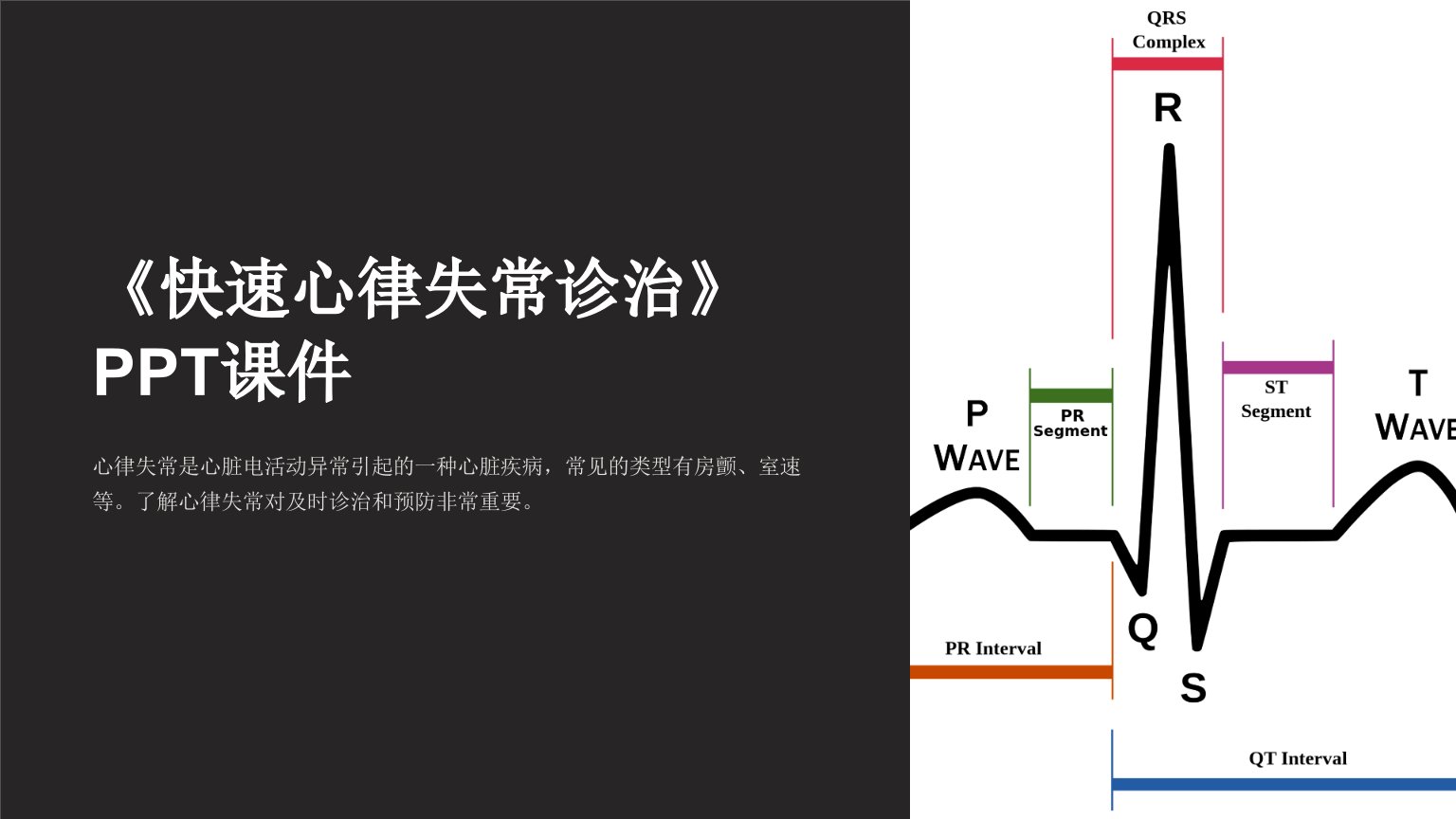 《快速心律失常诊治》课件