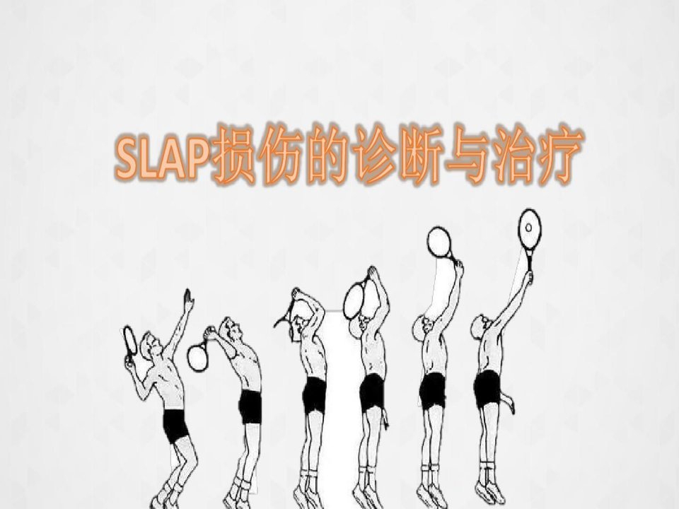 肩关节slap损伤的诊断与治疗