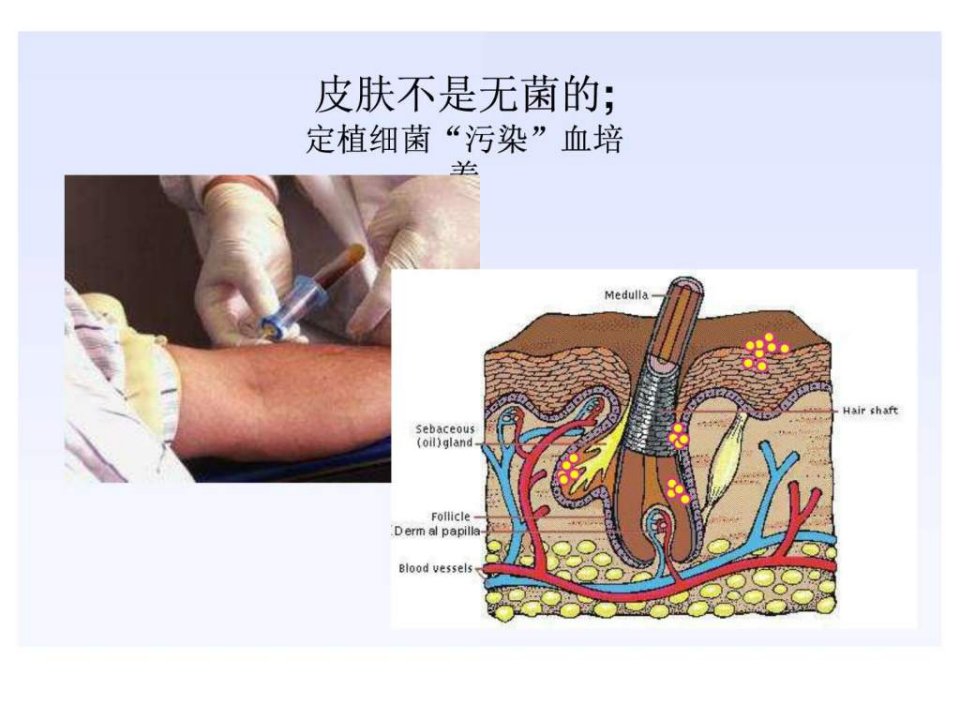 明确血培养的临床意义.课件