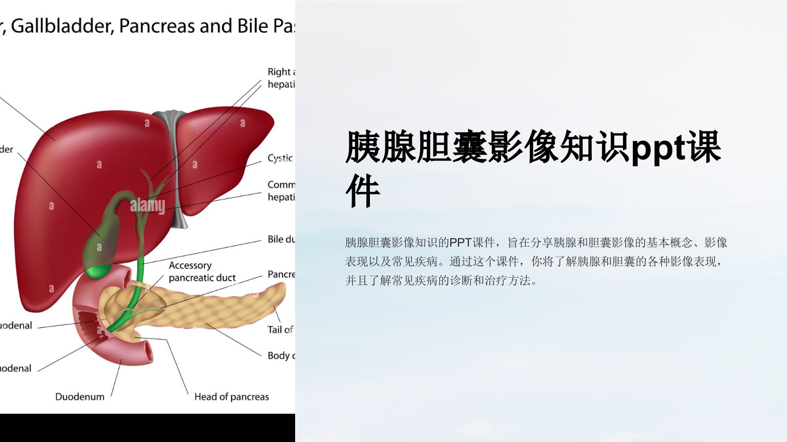 胰腺胆囊影像知识课件