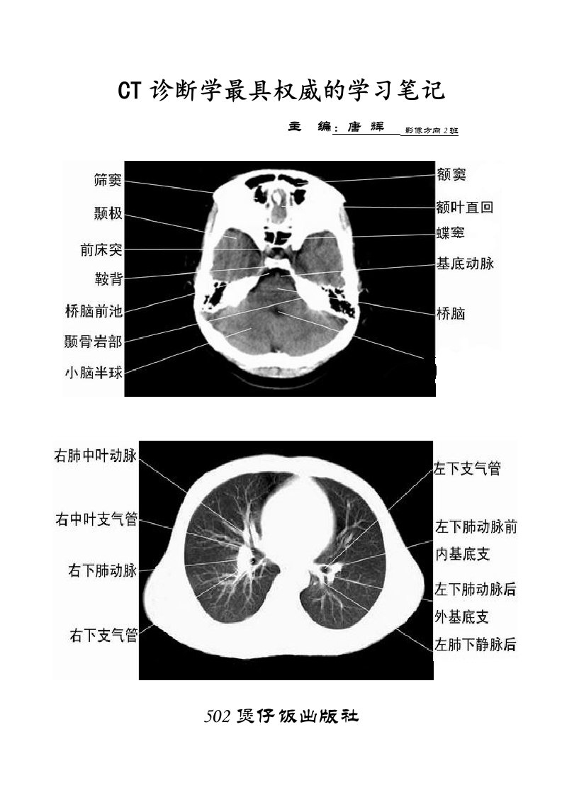 CT诊断学笔记目录