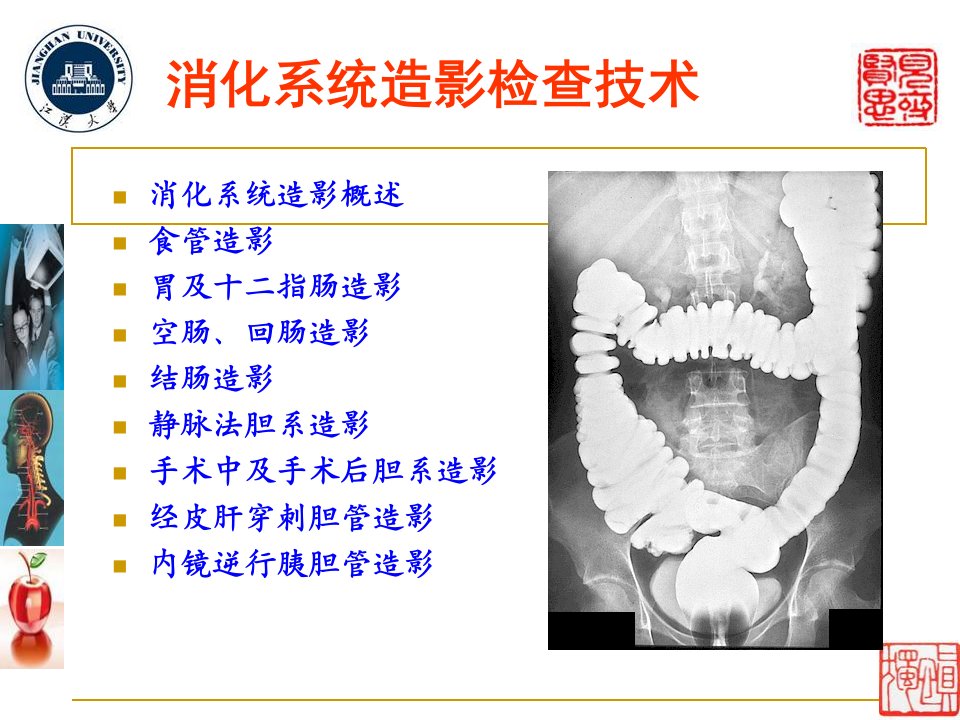 X线造影检查技术各论